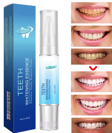 4ml Teeth Whitening Pen – Professionell Tandblekning för Fläckfria Vita Tänder